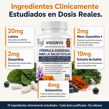 Visionyx Óptima